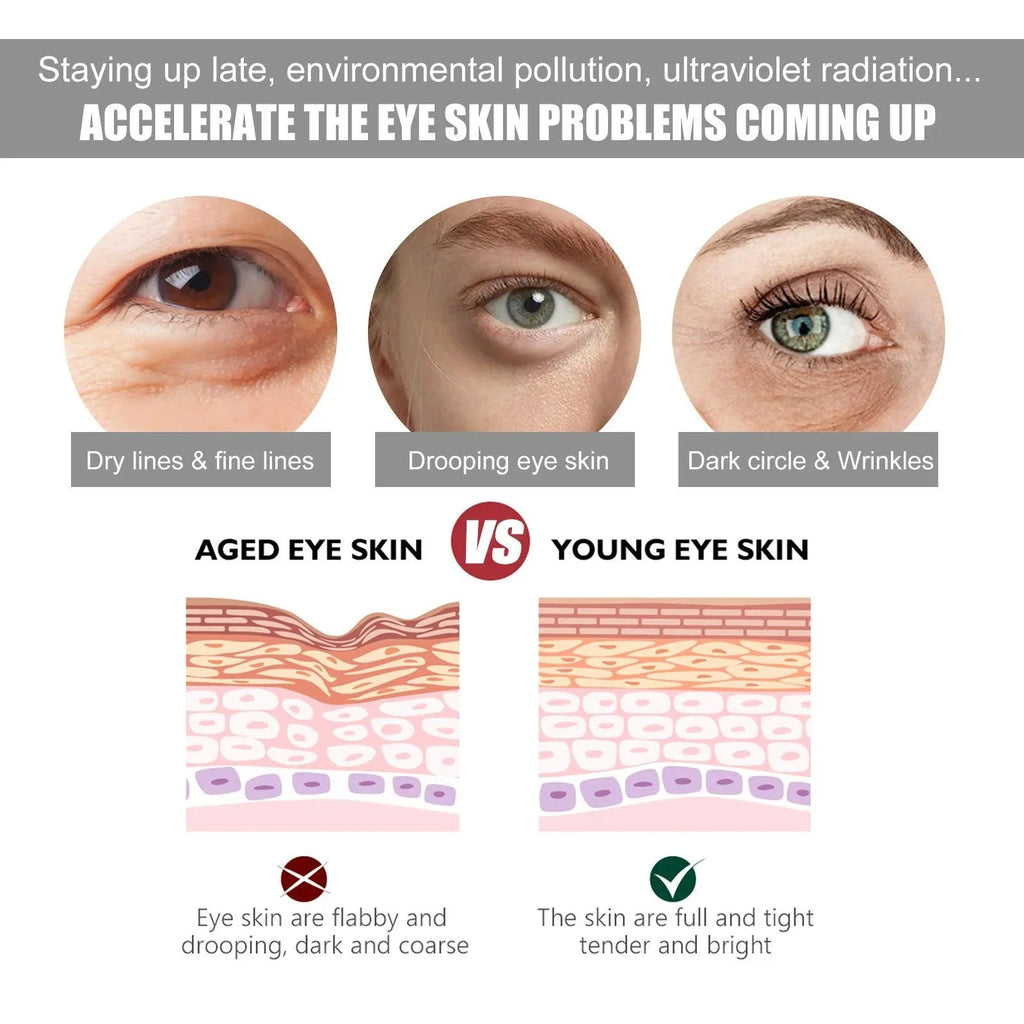 Moisturizing eye cream fade Fine lines repair canthus lines dark circles remove eye bags firming Aging anti-wrinkle eye cream
