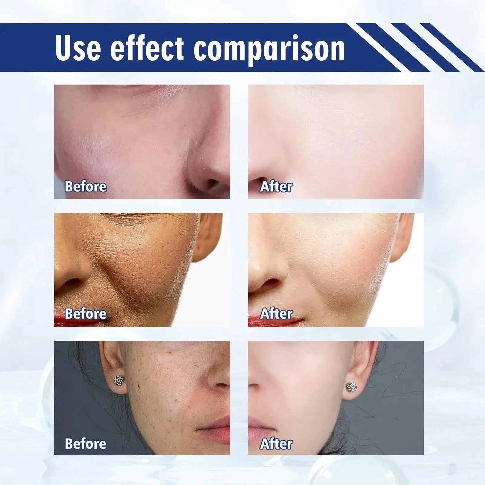 Effective Whitening Serum Remove Dark Spots Freckle Essence Anti-Aging Niacinamide Fade Pigmentation Melasma Brighten Skin Care - BEAUTIRON
