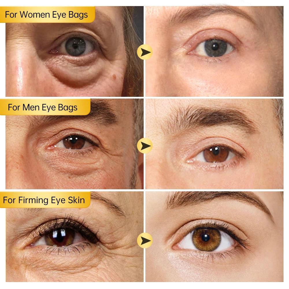 Peptide Dark Circles Removal Eye Cream Eye Bags Anti Puffiness Lightening Lifting Firming Eyes Skin Care Cosmetics