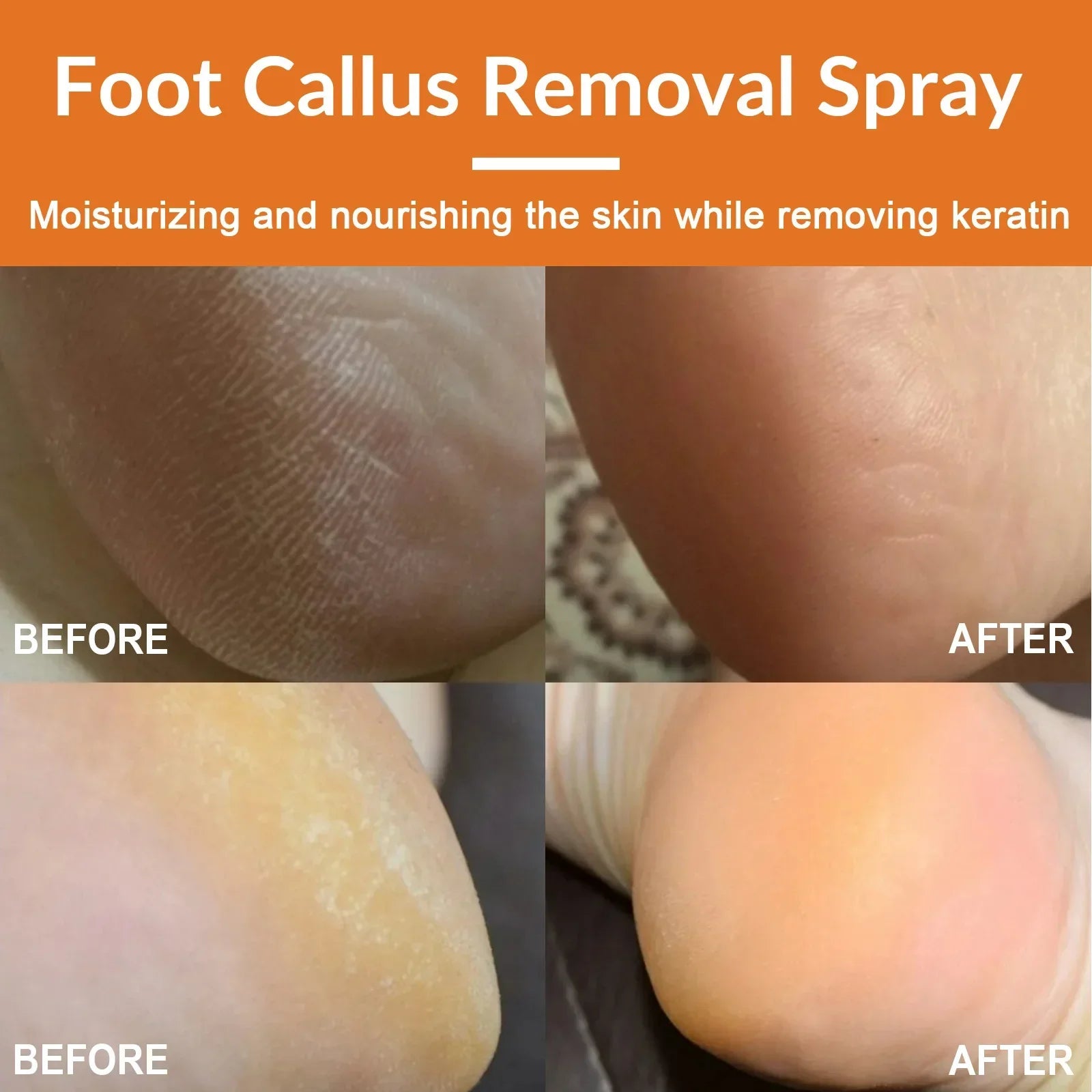 30ml Skin Remover Heel Dry Cracked Blister Repairing Pedicure Exfoliating Nourishing Foot Care Foot Peeling Spray Callus Dead