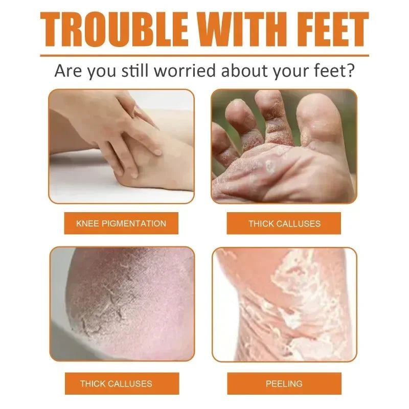 30ml Skin Remover Heel Dry Cracked Blister Repairing Pedicure Exfoliating Nourishing Foot Care Foot Peeling Spray Callus Dead