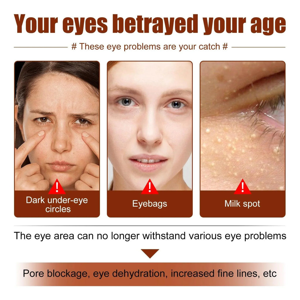 Dark Circles Remover Eye Cream Anti Puffiness Particles Removal Fade Fine Lines Under Repair Eye Bags Reduce Swelling Eye Care