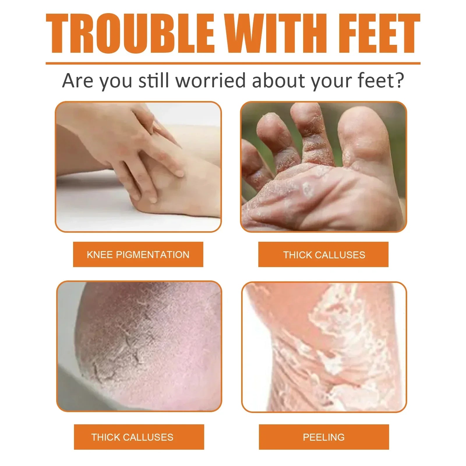 30ml Skin Remover Heel Dry Cracked Blister Repairing Pedicure Exfoliating Nourishing Foot Care Foot Peeling Spray Callus Dead