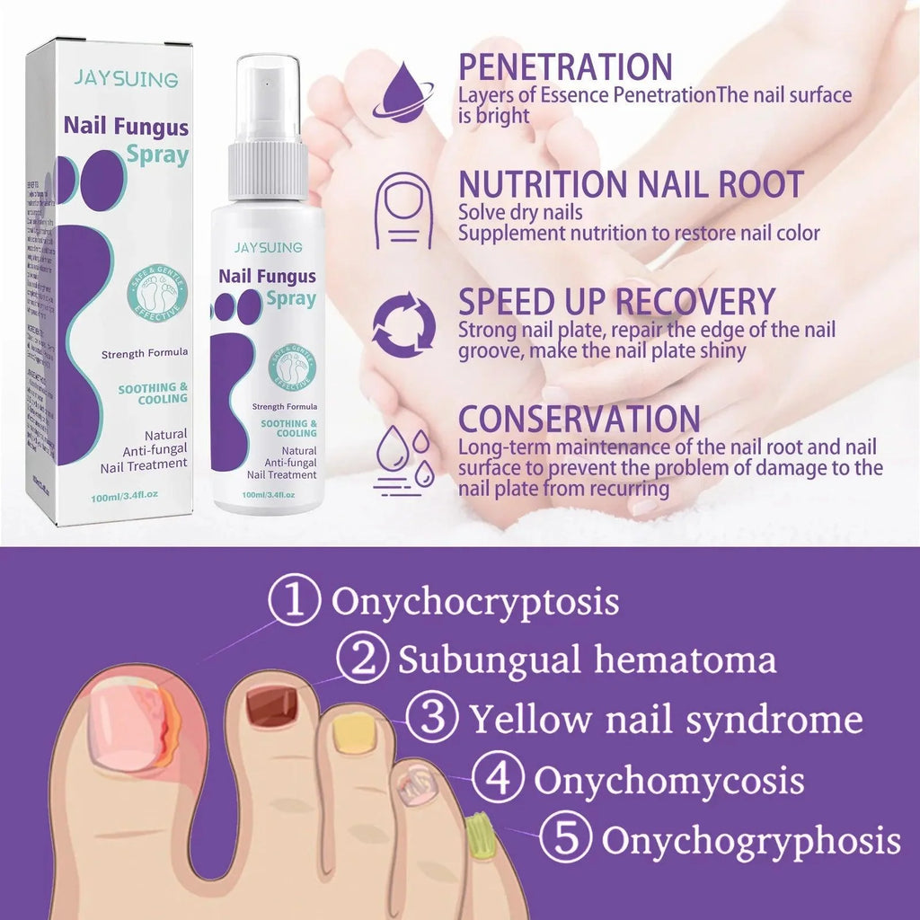 Onychomycosis Repair Spray Nail Fungus Treatment Hand Foot Soft Nail Ingrowing Thickening Nail Cleaning Care Hongos Uñas Pies