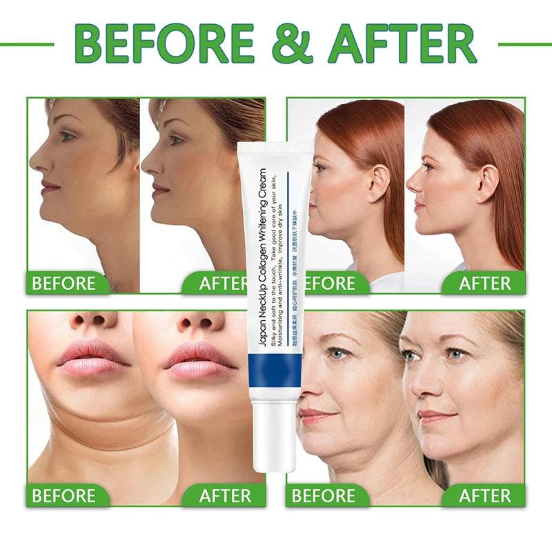 EELHOE Collagen Neck Cream Lifting Firming Anti-aging Efficient Reducing Fine Line Moisturizing Whitening Skincare 20g 2024
