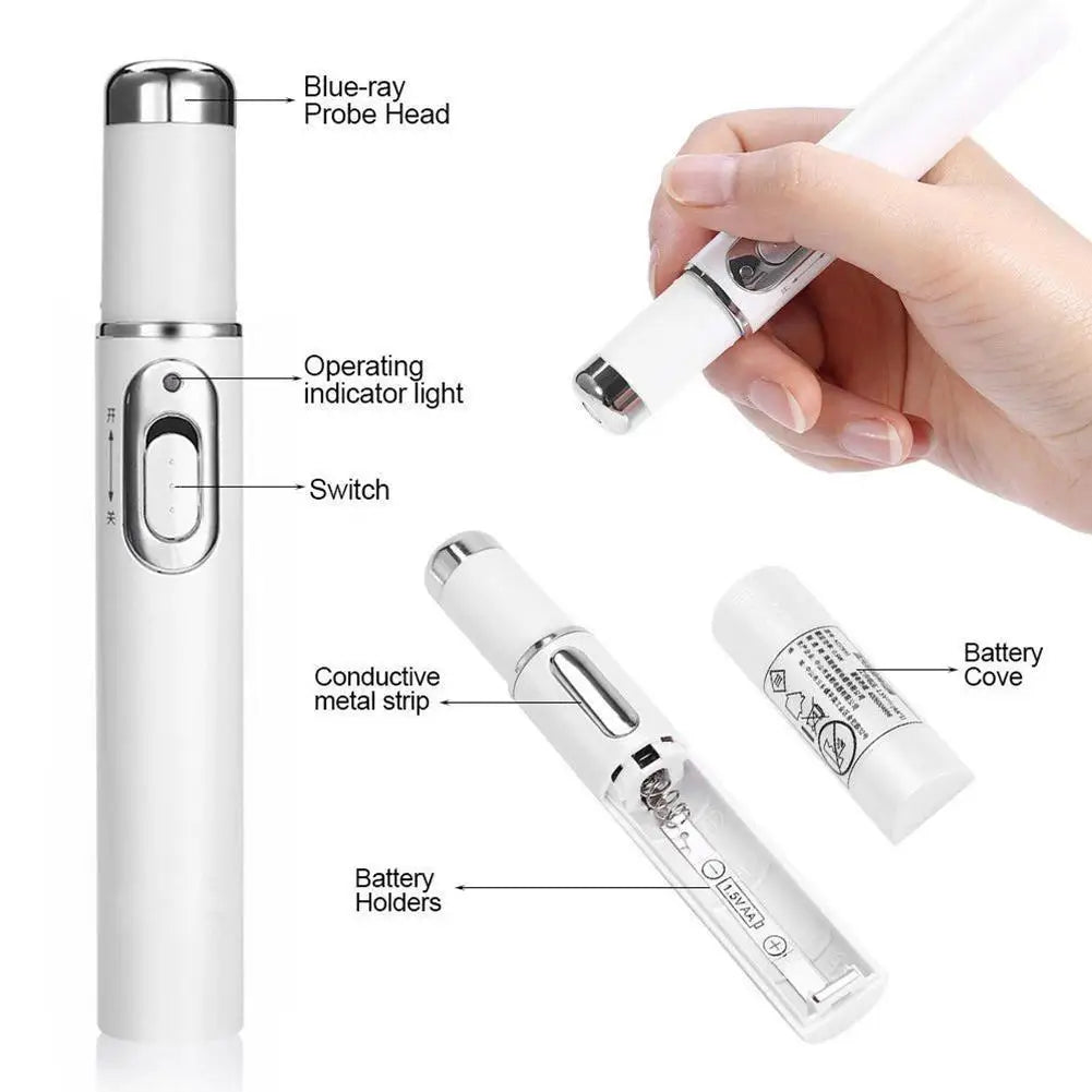 Skin Tag Removal Pen, Mole And Wart Removal Pen High-quality Anti Swelling Vessel Bulge Pain Blood Circulation