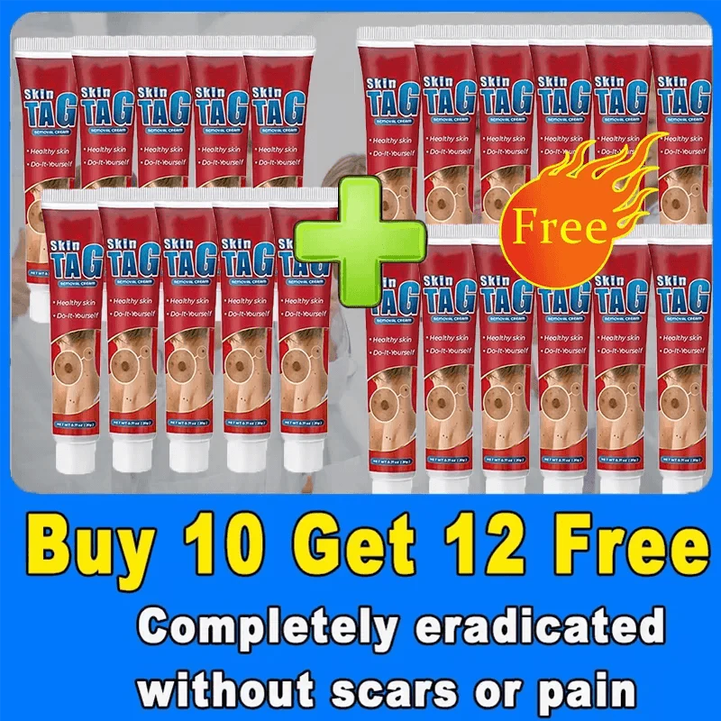 Wart, Freckle, Skin Tag, Mole, Dark Spot Removal Eyelift