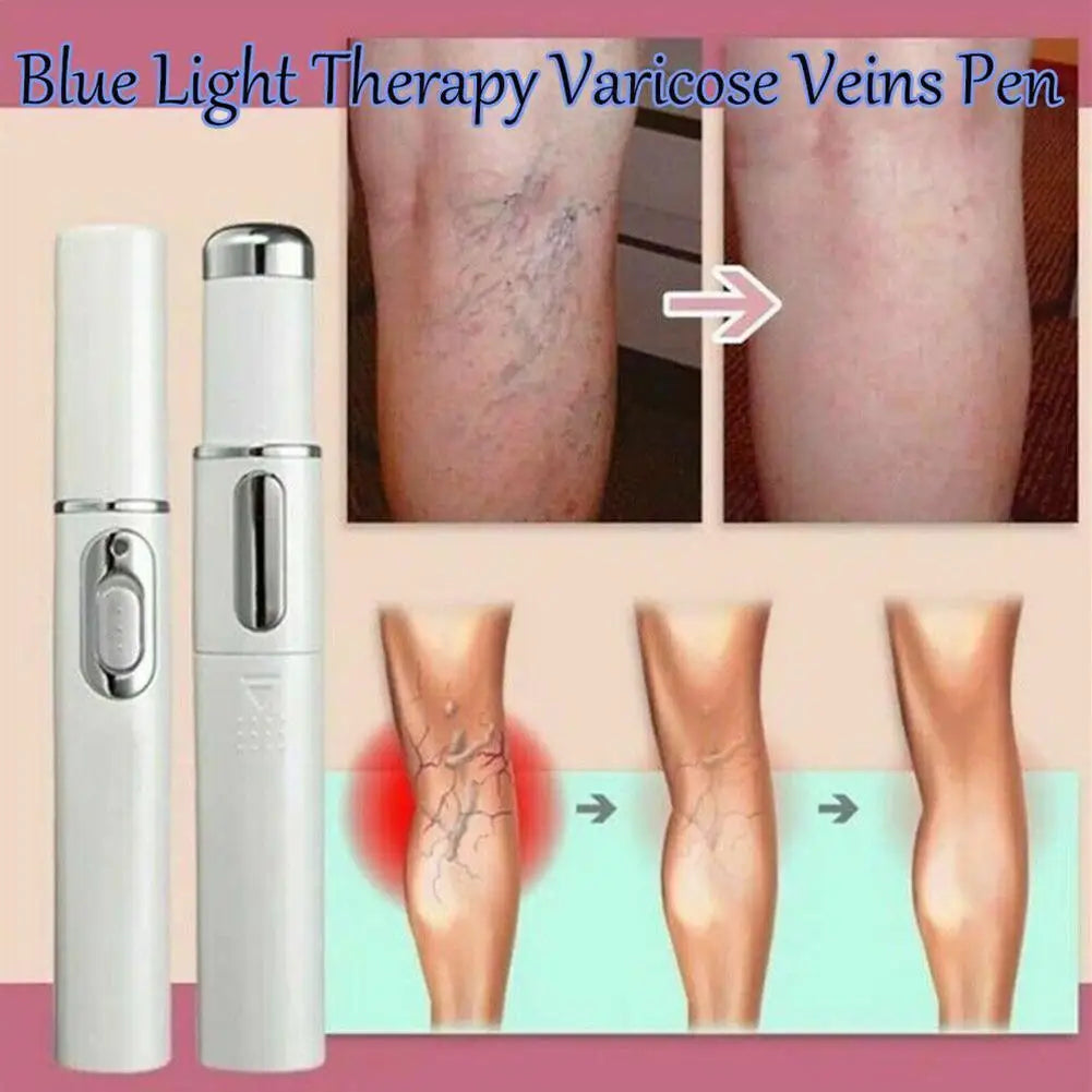 Skin Tag Removal Pen, Mole And Wart Removal Pen High-quality Anti Swelling Vessel Bulge Pain Blood Circulation