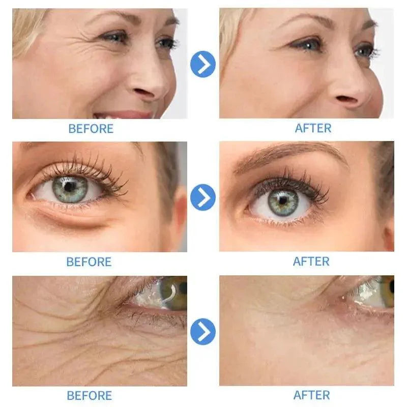 Retinol Anti Aging Remove Wrinkles Serum Firm Facial Essence Fade Eye Fine Line Moisturizing Lift Brighten Face Skin Care Beauty - BEAUTIRON