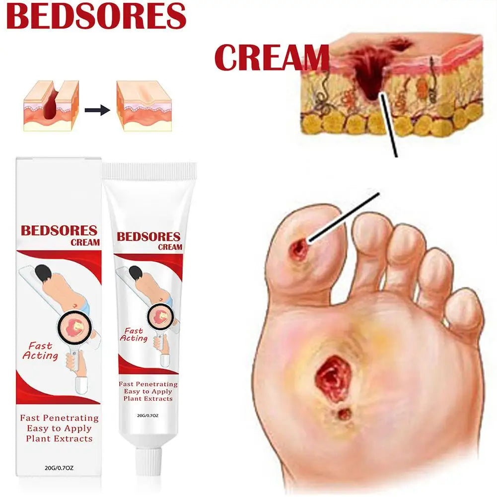 Bedsore Treatment Cream Pressure Sore Ulcer Skin Rot Necrotic Repair Relief Ointment Bed Sore Wound Healing Decubitus Feet Care