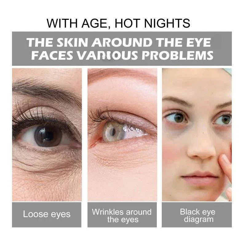 Moisturizing eye cream fade Fine lines repair canthus lines dark circles remove eye bags firming Aging anti-wrinkle eye cream