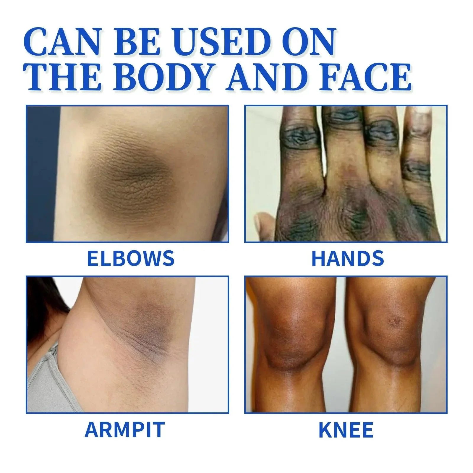 Brightening Body Cream Private Parts Underarm Bleaching Ankles Elbow Butt Remove Melanin Moisturize Inner Thigh Whitening Cream