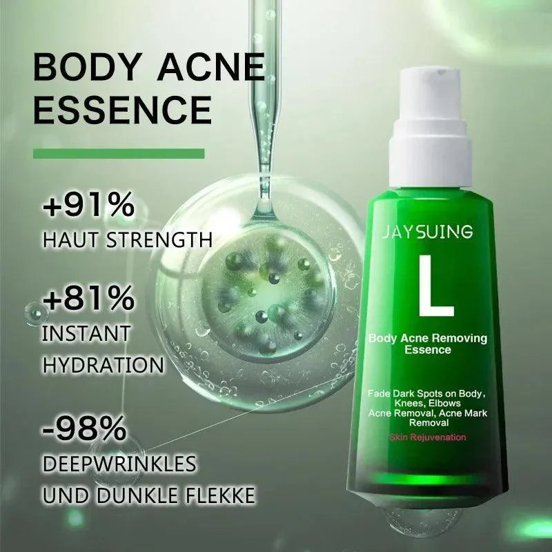 Acne serum for pimple for body and face