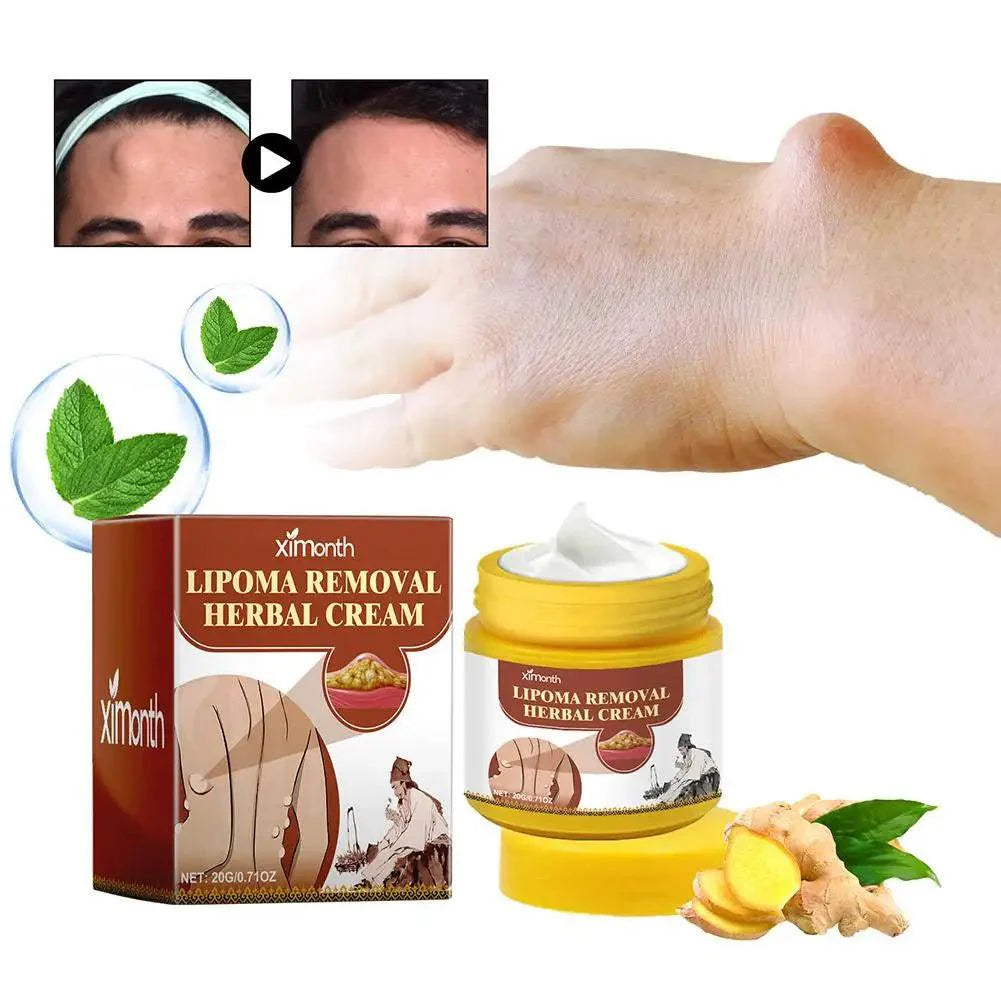 1pc Lipoma Removal Herbal Cream Body Cream Dissolving Fat Easy To Use Herbal Lipoma Removal Cream
