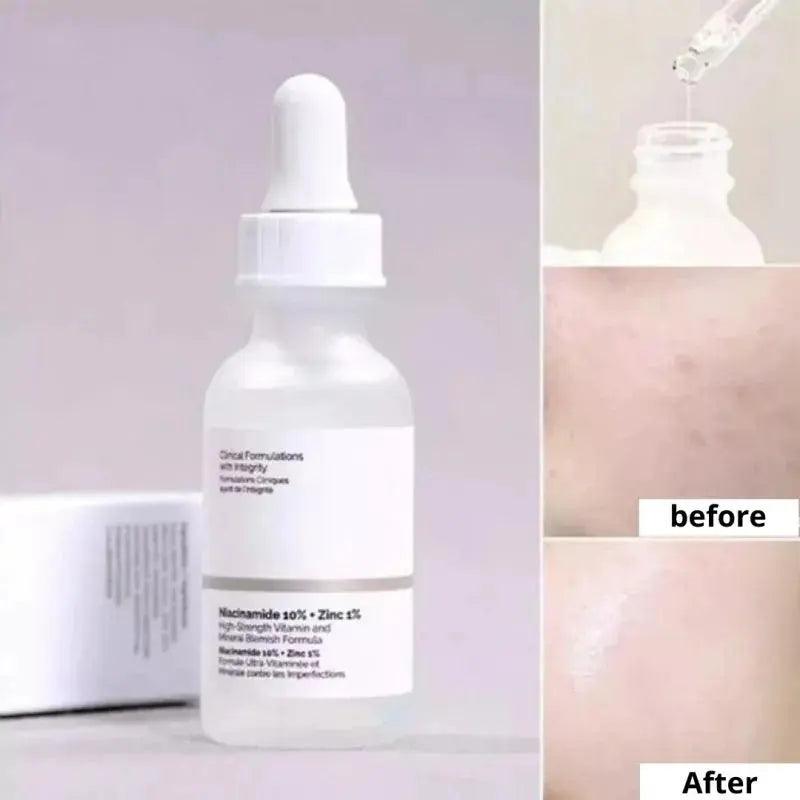 Original Niacinamide 10% + Zinc 1% B5 Essence Fruit Acid 30% Salicylic Caffeine Vitamin Moisturizes Tightens Soften Skin Care - BEAUTIRON
