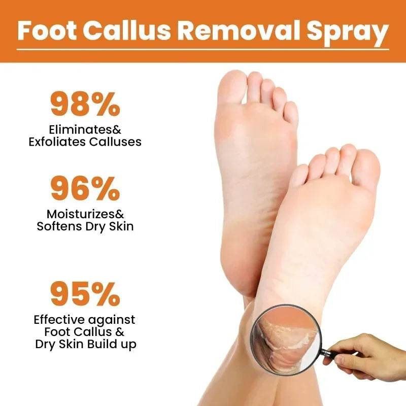 30ml Skin Remover Heel Dry Cracked Blister Repairing Pedicure Exfoliating Nourishing Foot Care Foot Peeling Spray Callus Dead