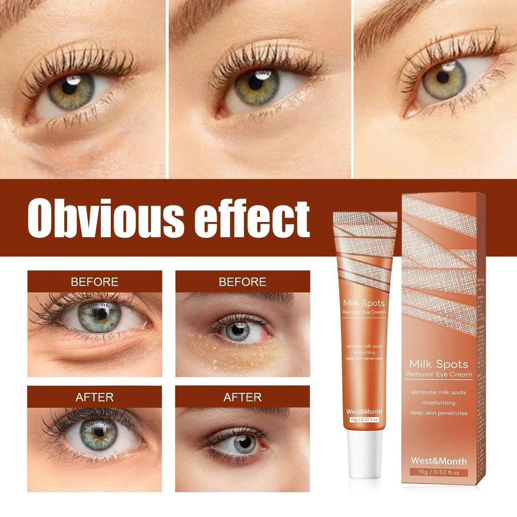 Dark Circles Remover Eye Cream Anti Puffiness Particles Removal Fade Fine Lines Under Repair Eye Bags Reduce Swelling Eye Care