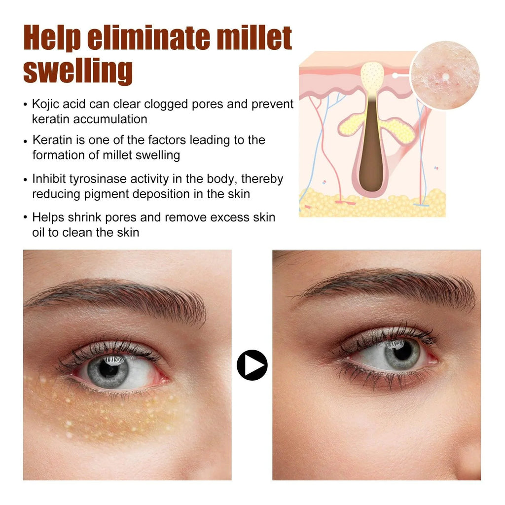 Dark Circles Remover Eye Cream Anti Puffiness Particles Removal Fade Fine Lines Under Repair Eye Bags Reduce Swelling Eye Care