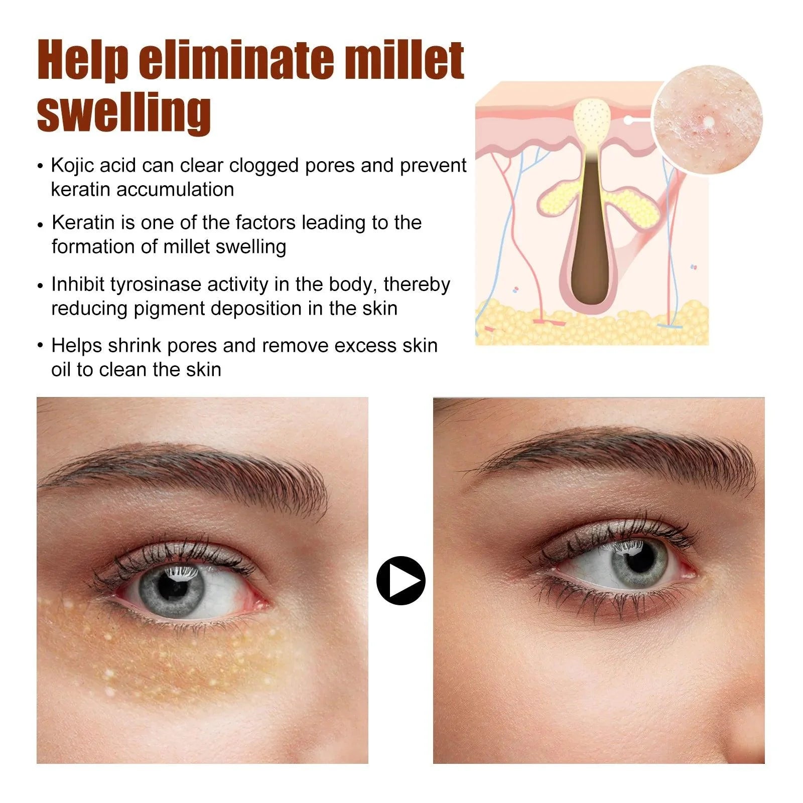 Dark Circles Remover Eye Cream Anti Puffiness Particles Removal Fade Fine Lines Under Repair Eye Bags Reduce Swelling Eye Care