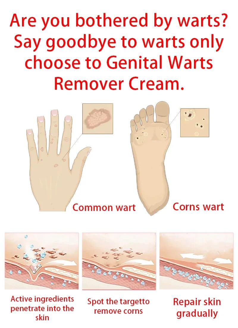 Wart, Freckle, Skin Tag, Mole, Dark Spot Removal Eyelift