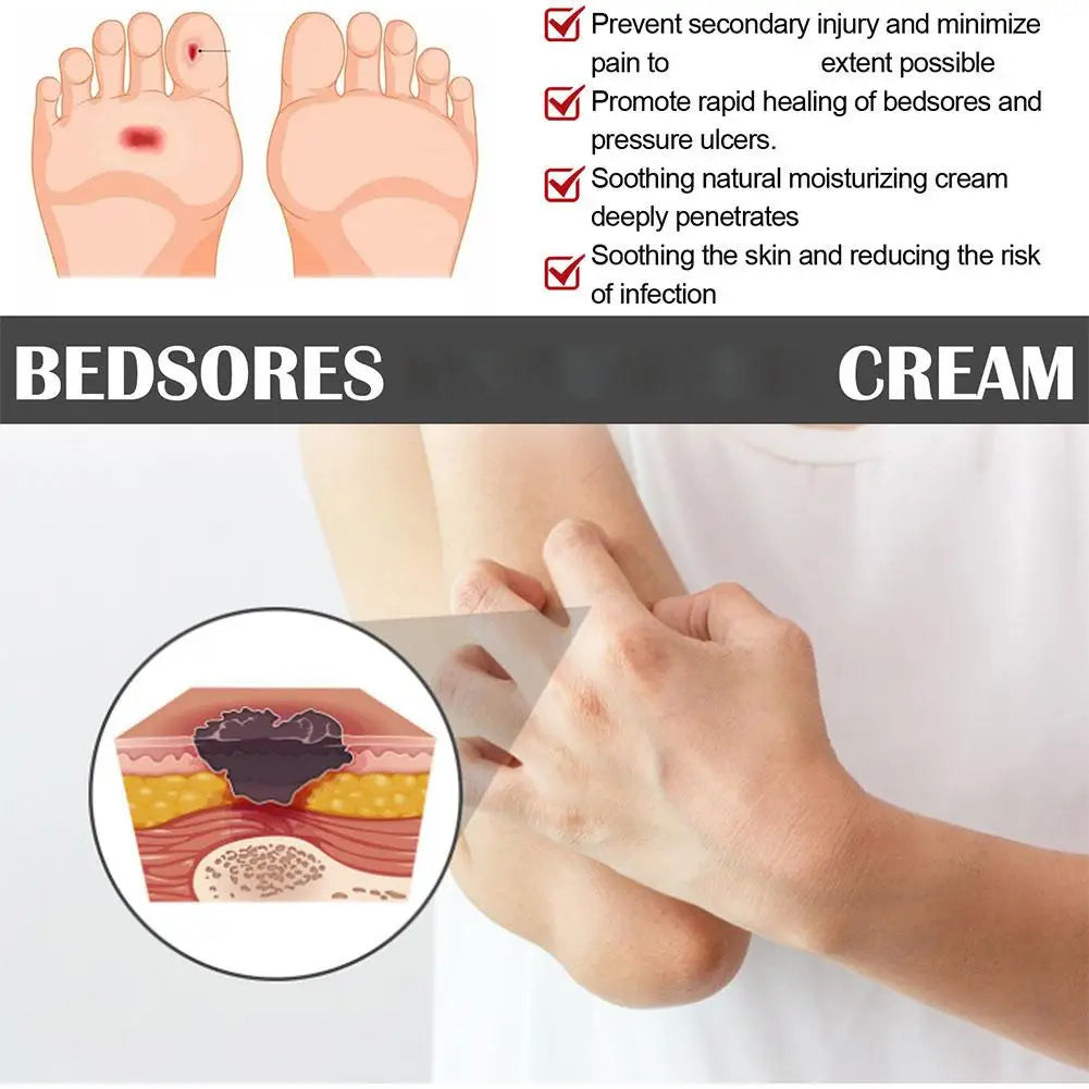 Bedsore Treatment Cream Pressure Sore Ulcer Skin Rot Necrotic Repair Relief Ointment Bed Sore Wound Healing Decubitus Feet Care