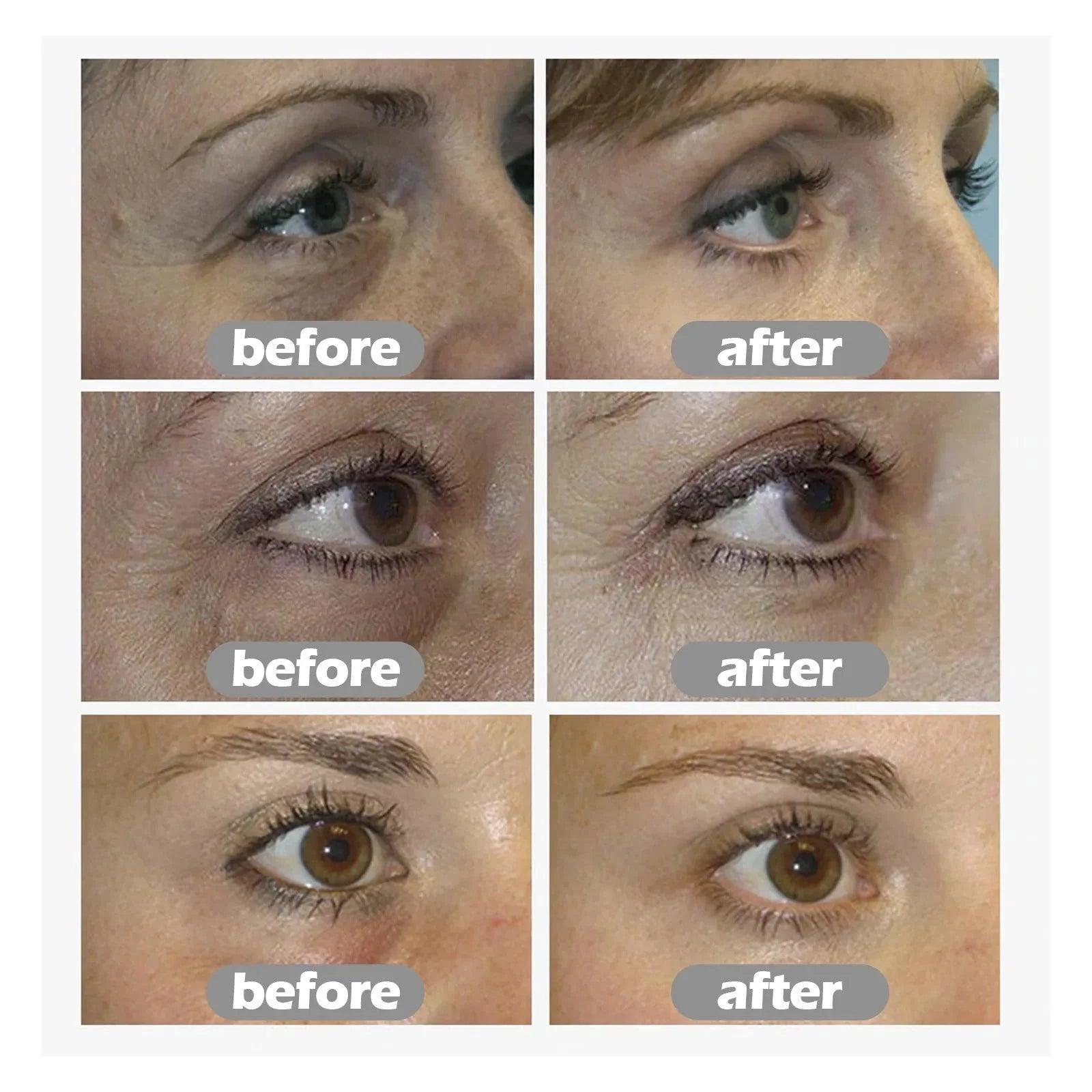 Moisturizing eye cream fade Fine lines repair canthus lines dark circles remove eye bags firming Aging anti-wrinkle eye cream