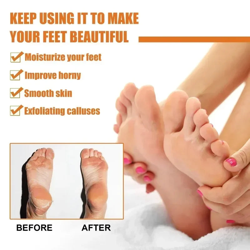 30ml Skin Remover Heel Dry Cracked Blister Repairing Pedicure Exfoliating Nourishing Foot Care Foot Peeling Spray Callus Dead