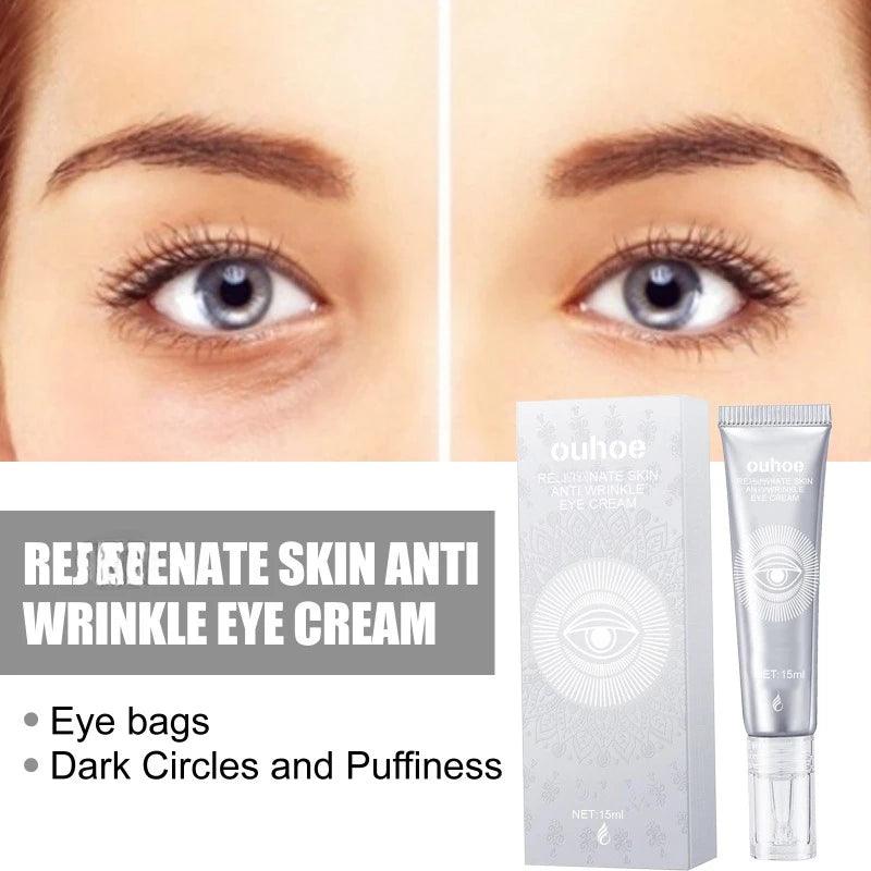 Moisturizing eye cream fade Fine lines repair canthus lines dark circles remove eye bags firming Aging anti-wrinkle eye cream
