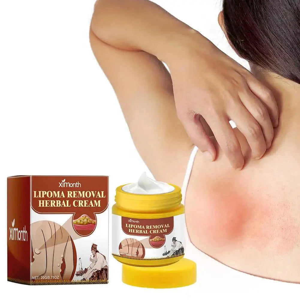 1pc Lipoma Removal Herbal Cream Body Cream Dissolving Fat Easy To Use Herbal Lipoma Removal Cream