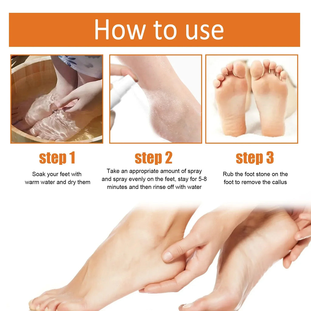 30ml Skin Remover Heel Dry Cracked Blister Repairing Pedicure Exfoliating Nourishing Foot Care Foot Peeling Spray Callus Dead