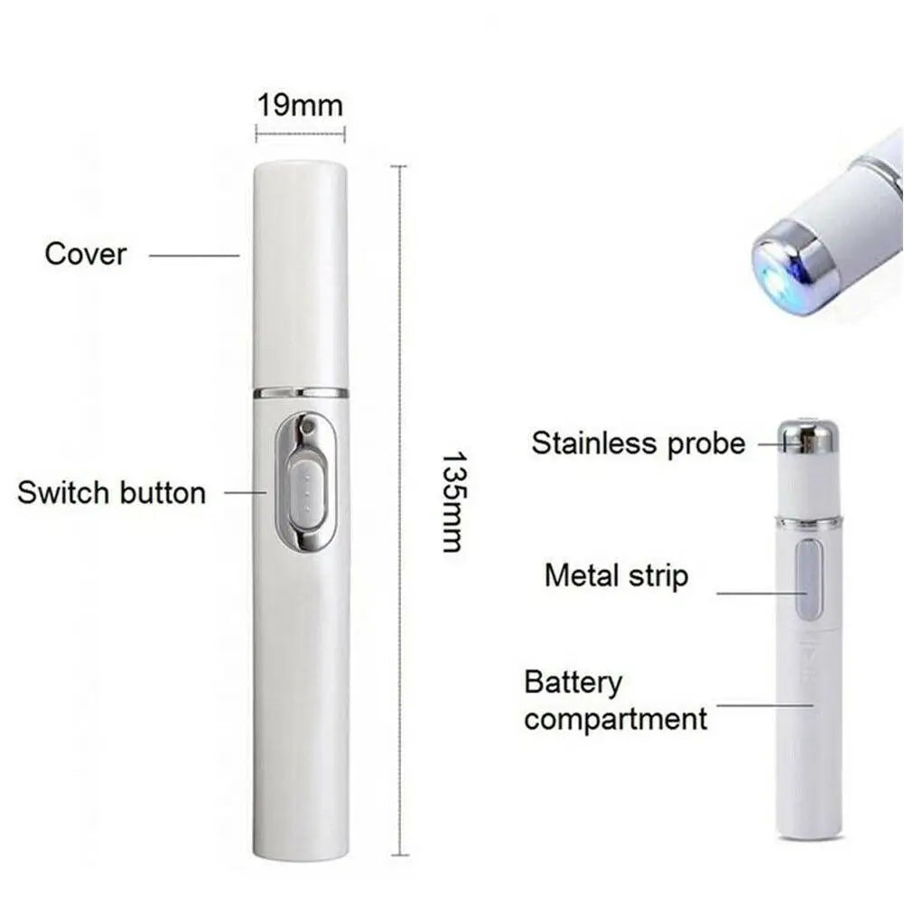 Skin Tag Removal Pen, Mole And Wart Removal Pen High-quality Anti Swelling Vessel Bulge Pain Blood Circulation