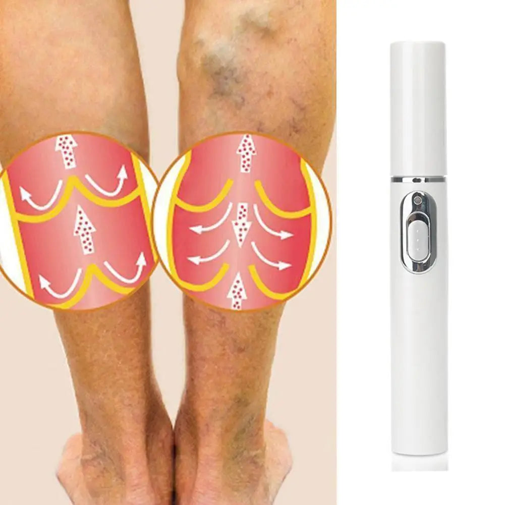 Skin Tag Removal Pen, Mole And Wart Removal Pen High-quality Anti Swelling Vessel Bulge Pain Blood Circulation