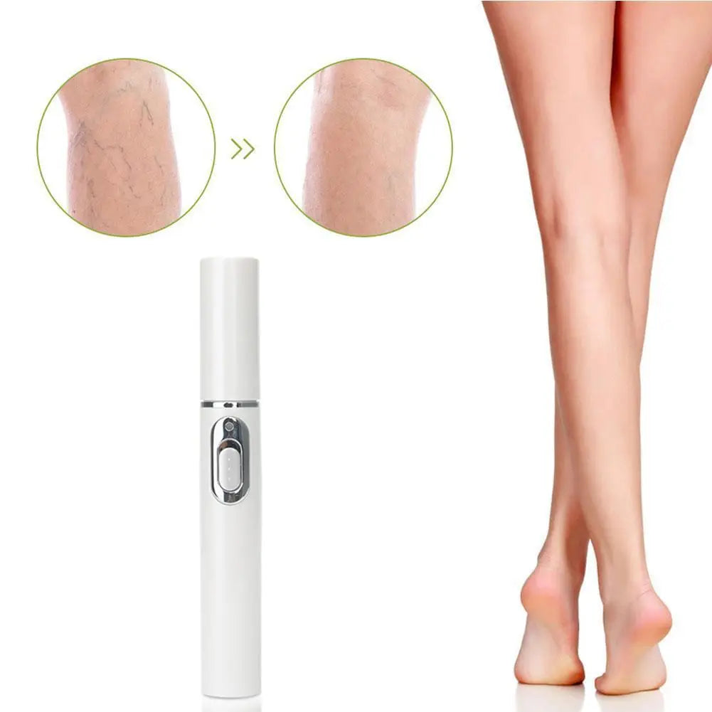 Skin Tag Removal Pen, Mole And Wart Removal Pen High-quality Anti Swelling Vessel Bulge Pain Blood Circulation