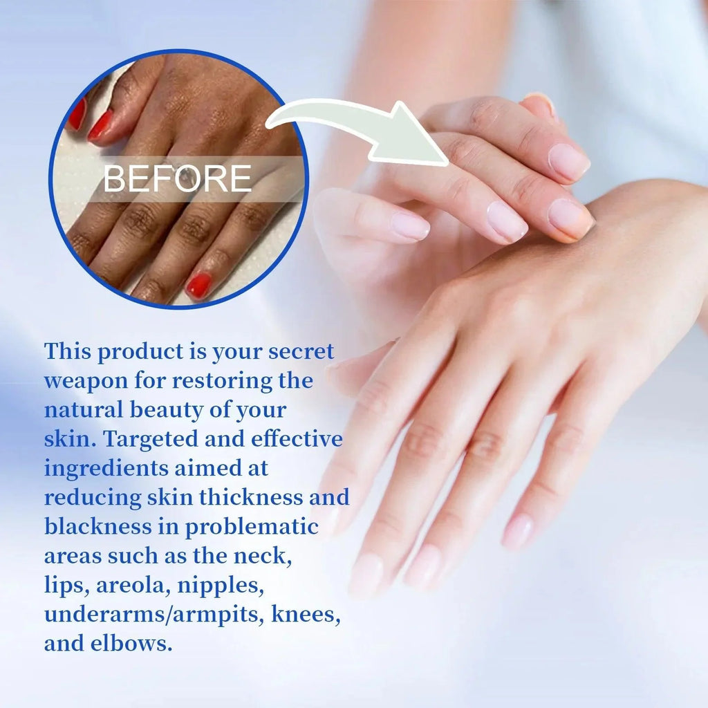 Brightening Body Cream Private Parts Underarm Bleaching Ankles Elbow Butt Remove Melanin Moisturize Inner Thigh Whitening Cream