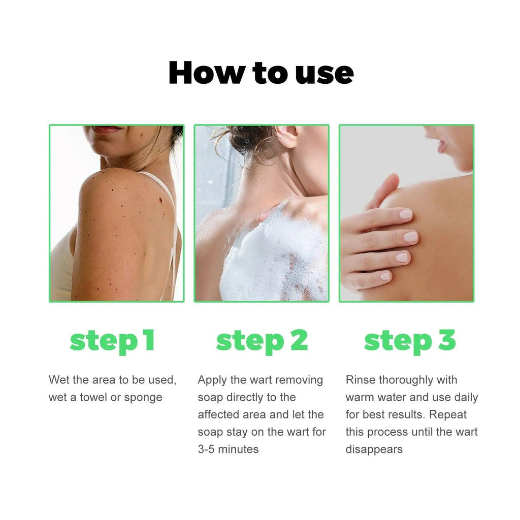 Mole Removal G Wart Grain Filamentous Wart Body Cleaning Soap - BEAUTIRON