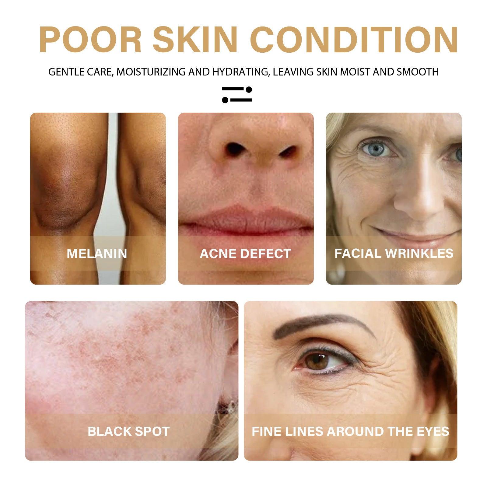 Fine Lines And Wrinkles Skin Moisturizing And Moisturizing Zera