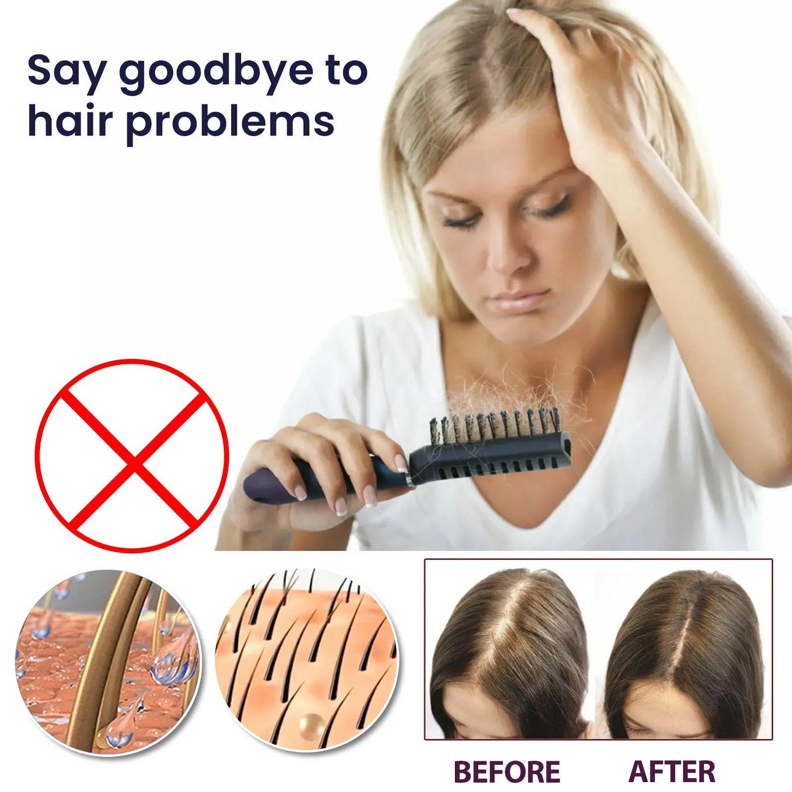 Hair Growth Spray Moisturizes Damaged Hair Zera