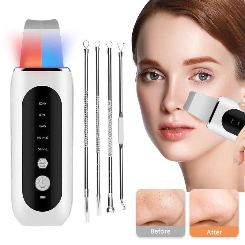 Ultrasonic Face Skin Scrubber - Zera