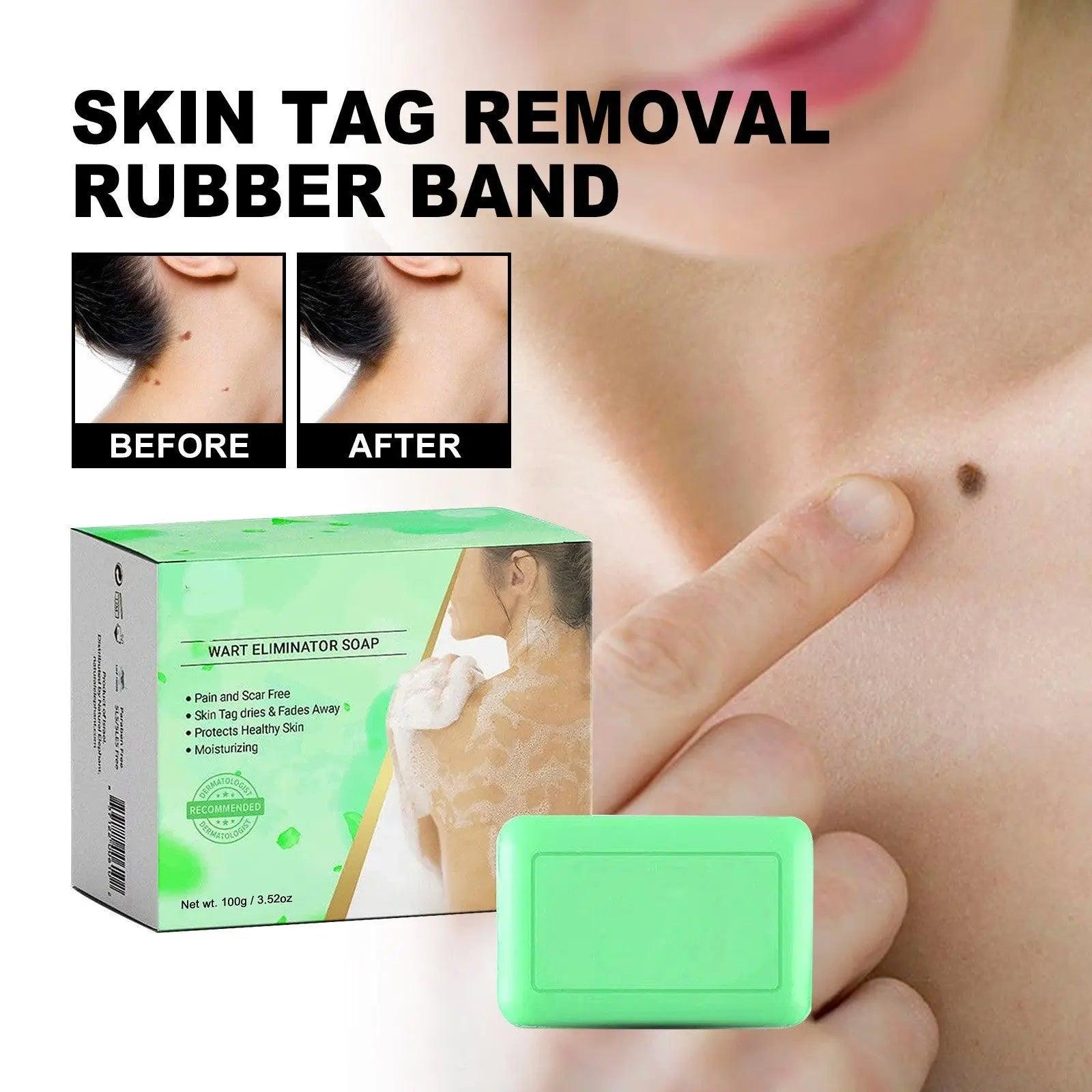 Mole Removal G Wart Grain Filamentous Wart Body Cleaning Soap - BEAUTIRON