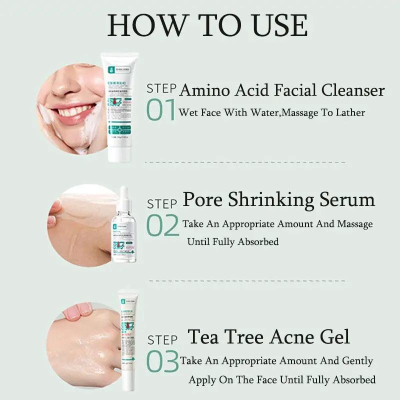 Herbal Acne Removal Face Cream - Zera