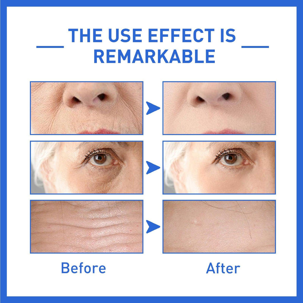 Collagen Anti-Wrinkle Lightens Facial Fine Lines And Wrinkles