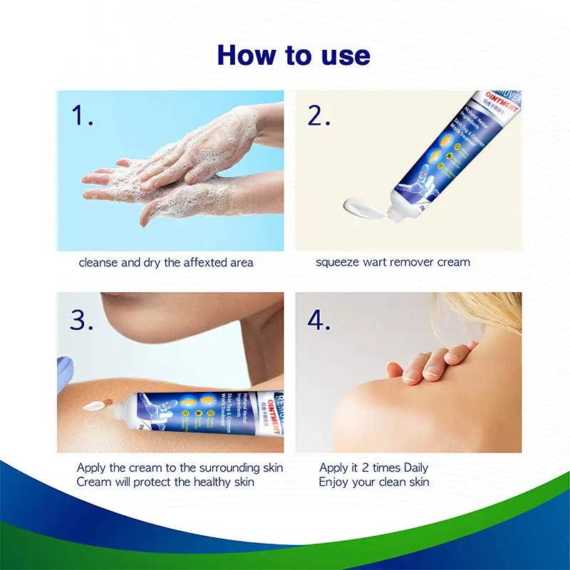 Warts Remover Antibacterial Ointment Wart Treatment Cream Skin Tag Remover Herbal Extract Corn Plaster Warts Ointment - BEAUTIRON