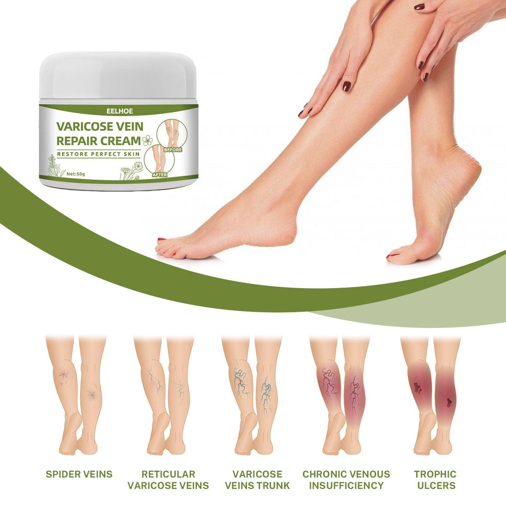 Intravenous Cream To Dredge The Veins And Relieve The Legs