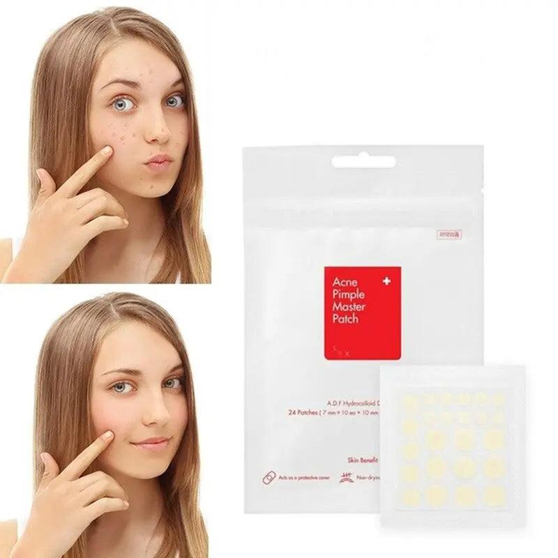 Face Spot Scar Care Treatment Stickers - Zera