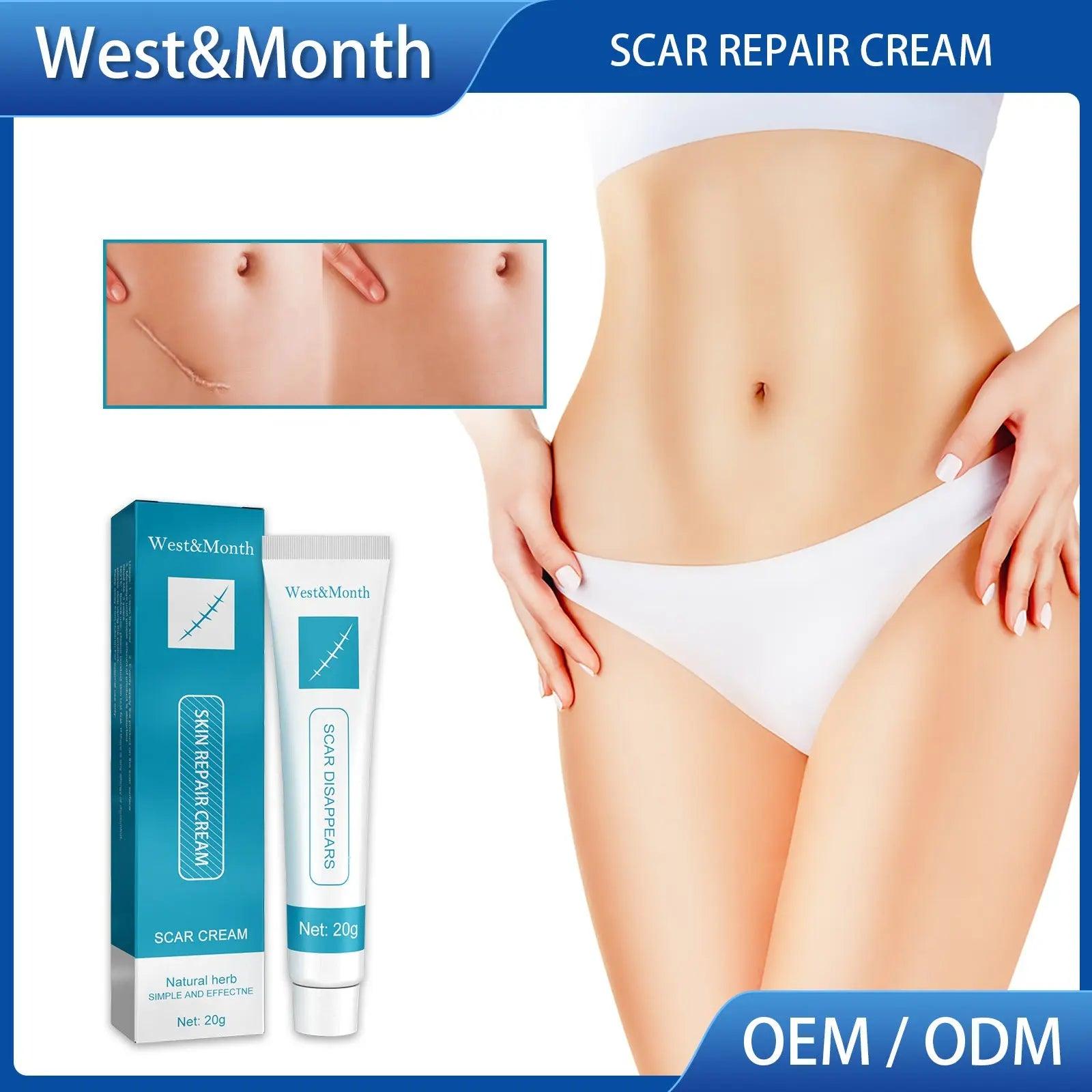 Scar Repair Cream Desalinates Old Scald Burns - BEAUTIRON