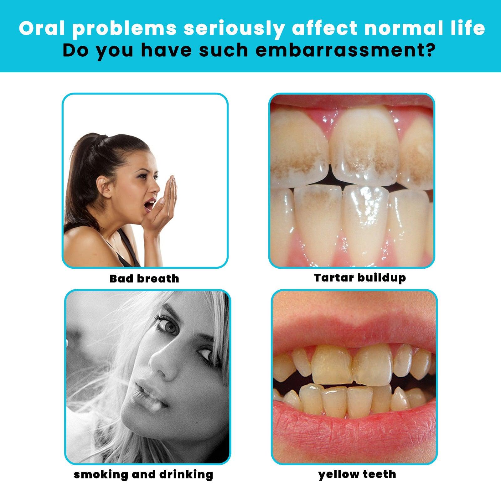 White Teeth Mousse Cleaning Toothpaste