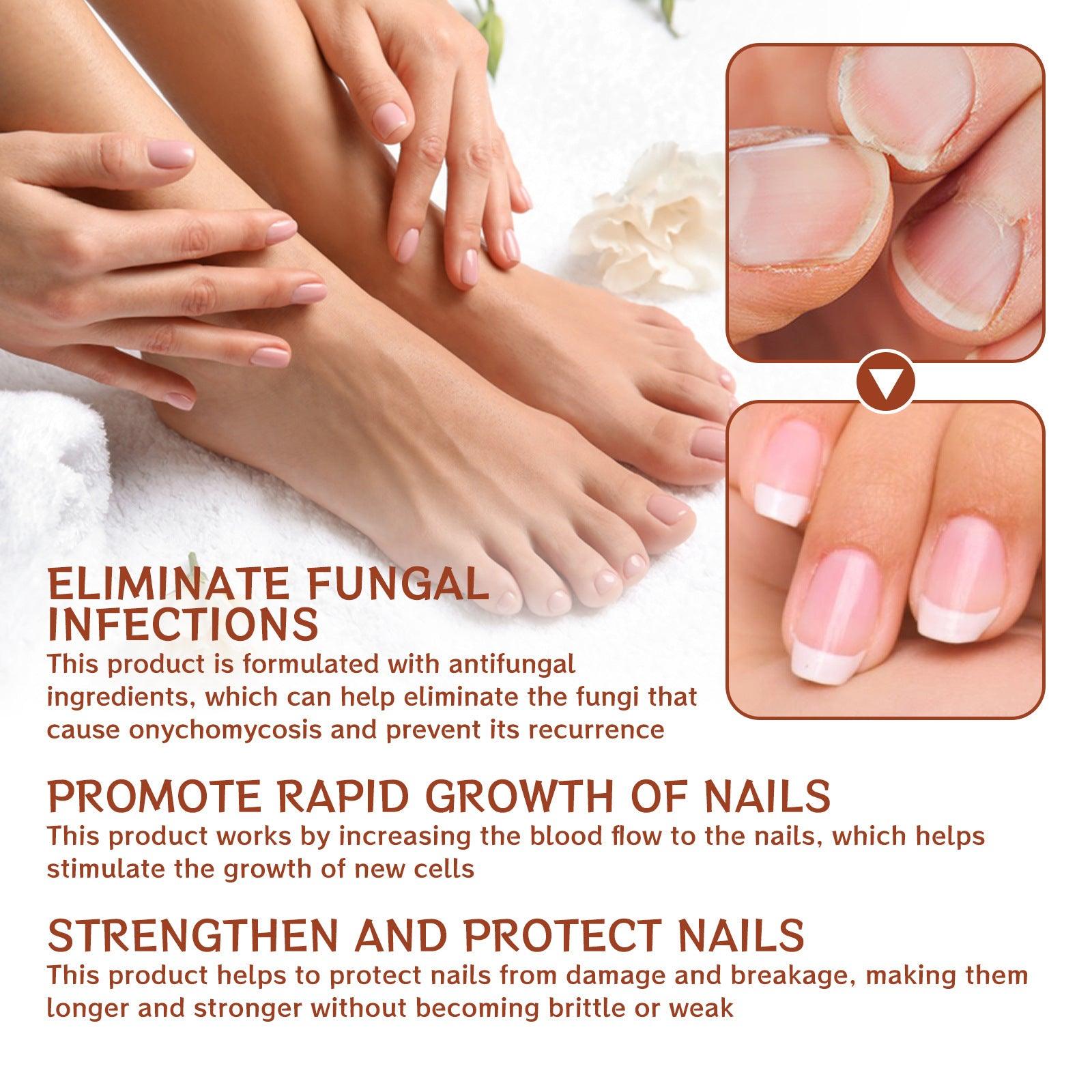 Repair Inlay Nail Thickening Type Dust Hand And Foot Nail Repair