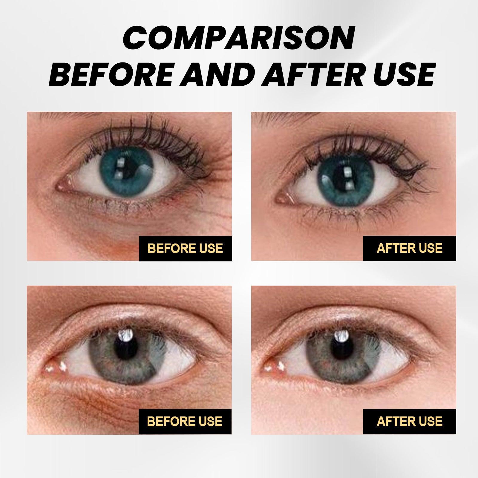 Fade Wrinkles Moisture Replenishment Firming Eye Skin Eye Cream